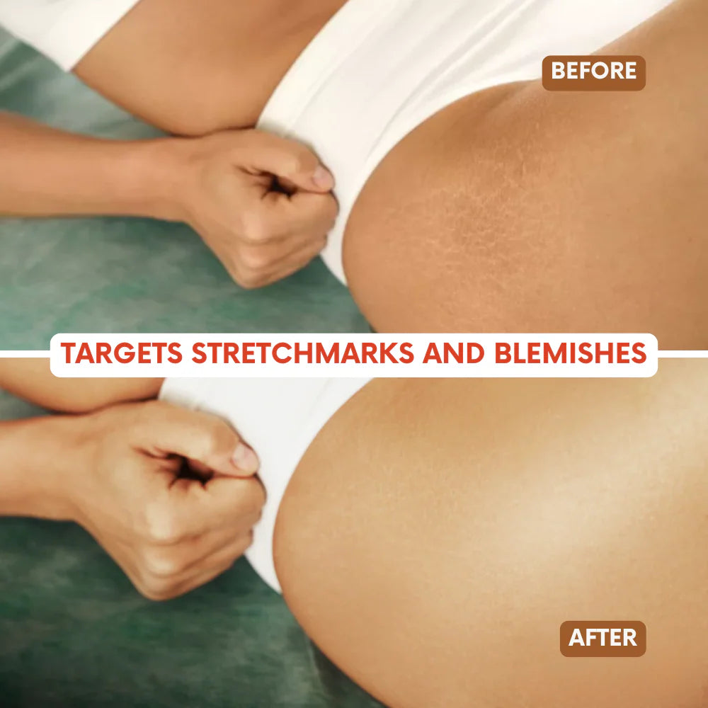 Lumiere Magic Body Oil - Plumps, Tightens & Hydrates Skin