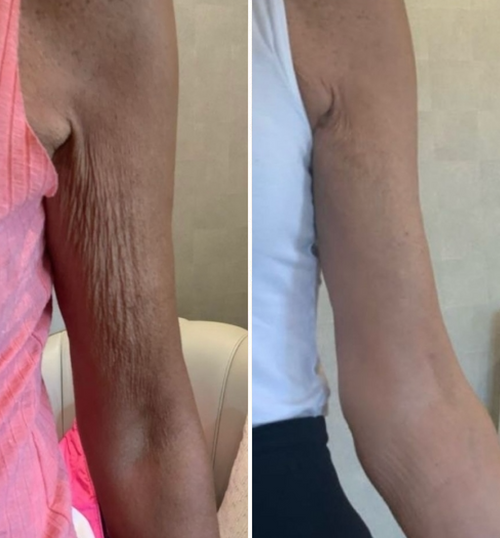 Lumiere Magic Body Oil - Smooths Crepey, Thinning Skin